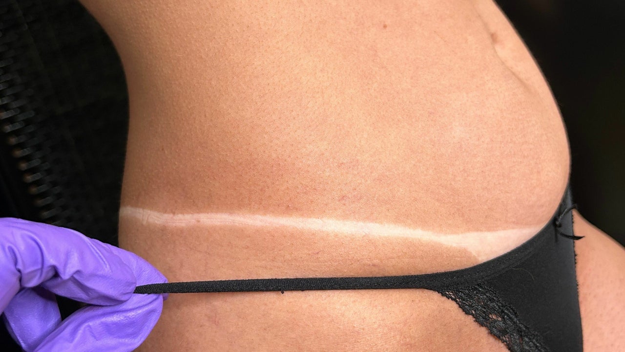 742295b7-2975-4625-b08f-a9377000762d-bodywisetanning-gb-england-latchingdon-fresha-5271522