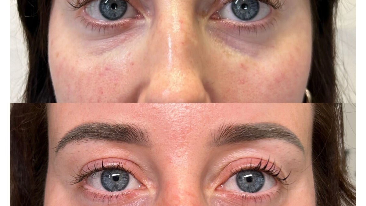 75800fe1-de2d-482a-aeb2-be5e88240eb7-kentbeautyandaesthetics-gb-tunbridgewells-fordcombe-fresha-7459513