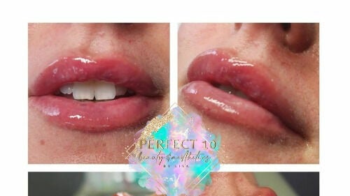 7691c76a-8d14-45d9-8781-958ebefc7670-5542502