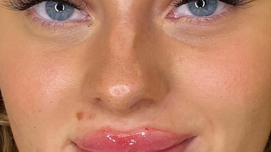 784a58ca-354b-471d-9e38-0dcf8ab7d60b-greenhouseaesthetics-gb-england-sevenoaks-fresha-2472244