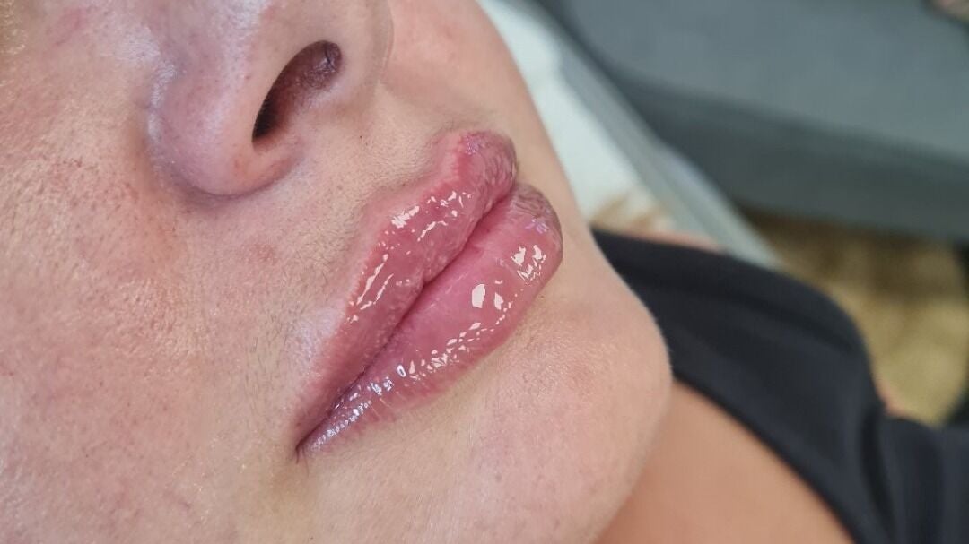 7c4c54cd-4b79-4b50-89e3-b7b1dfc64ce9-sanctumaestheticsandtrainingacadamy-gb-england-huddersfield-paddock-fresha-3712196