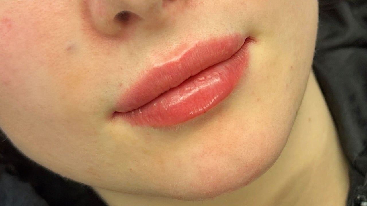 7c787343-9fc3-491f-9d10-a153002f5b1a-anatomicaaesthetics-gb-scotland-glasgow-dalmarnock-fresha-9278630