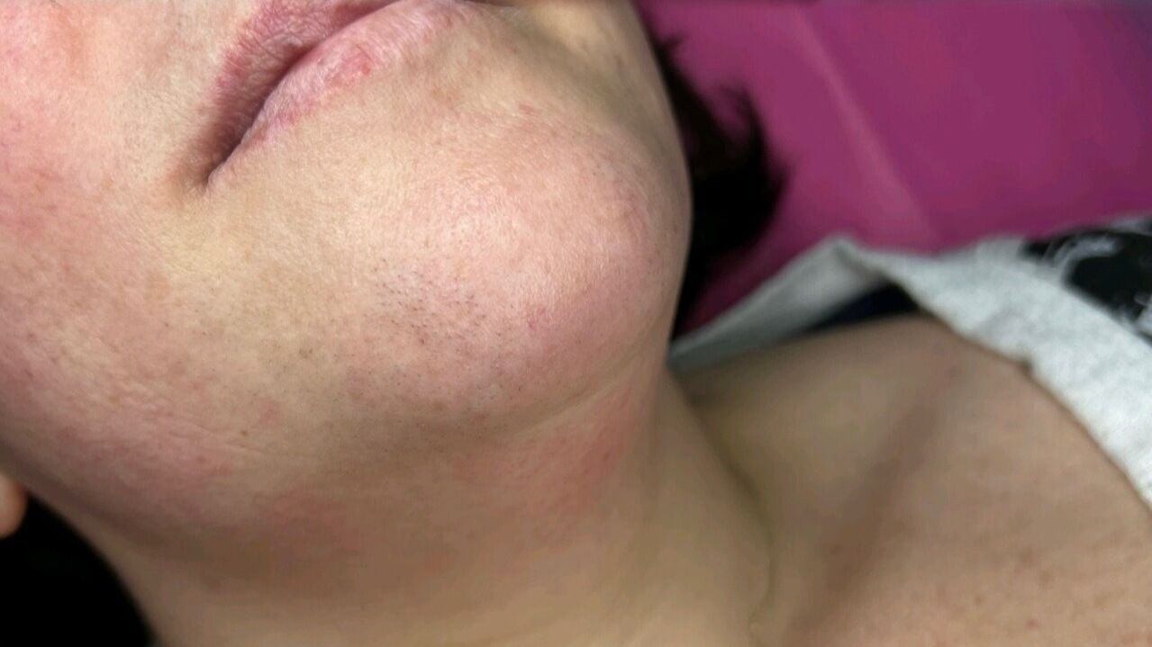 7ef37cb1-2658-465d-9a04-6084bc86c9b5-eplaserclinicshrewsbury-gb-england-shrewsbury-fresha-7645459