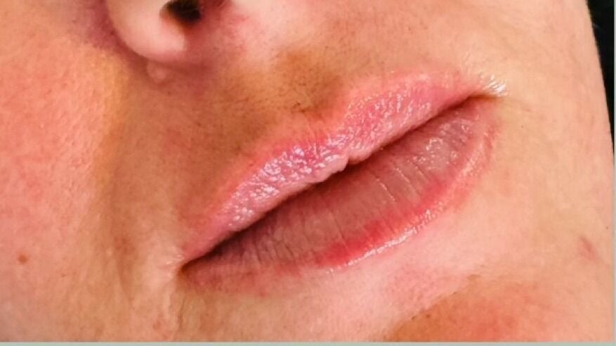 7f856b6f-58ee-4bac-93c9-248bbb4eeec7-abipetersaestheticsbedhampton-gb-unitedkingdom-bedhampton-fresha-8057999