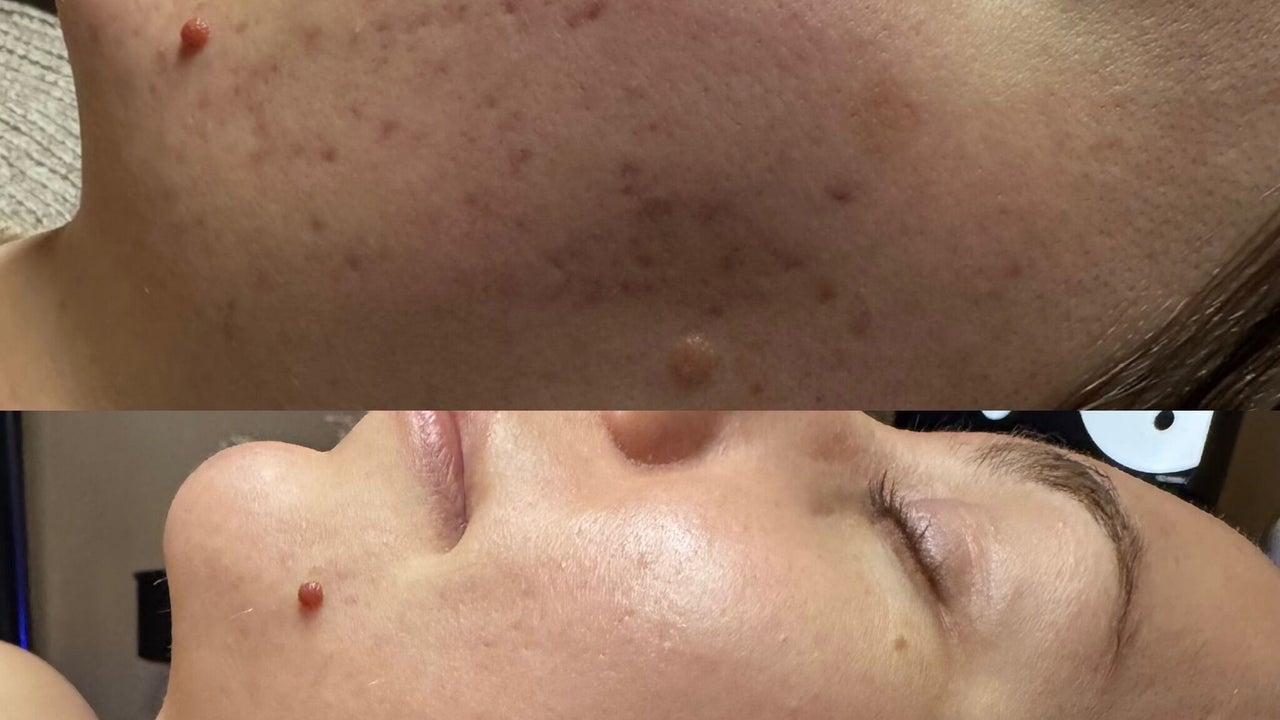 7f943484-a929-4bec-be36-c2a356212f28-signatureskin-gb-england-taverham-fresha-1284662