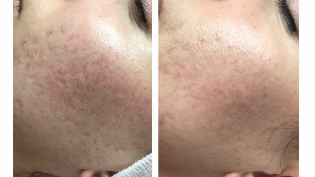 80b84029-502c-4f7d-bf00-8c67ff0f48cf-holliesskincare-garstang-gb-england-garstang-fresha-5305942