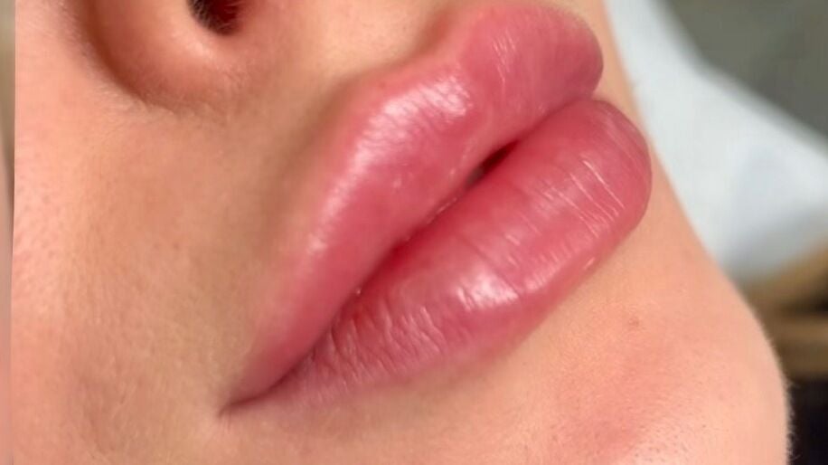 81a582e9-3e54-4691-b682-5c5f57326104-pureaestheticsnowzephyraestheticsskinstudio-gb-england-chester-le-street-birtley-fresha-2676841