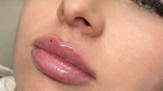 81c558fe-056e-4dd7-a971-d5fbe172303a-8827714