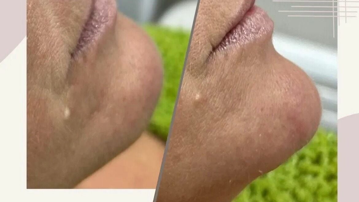 82303457-bb1a-4c46-ad8c-236750dcea9c-freshglowaesthetics-gb-england-cheslynhay-cheslynhay-fresha-6043353