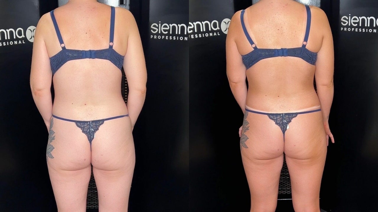 8310be39-2089-4b48-b5de-b7fa8d84aaa8-bodywisetanning-gb-england-latchingdon-fresha-8539841