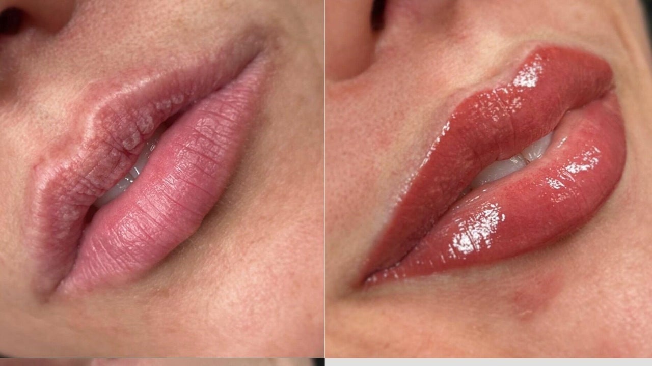 83adf090-48dc-4f3a-891e-4edbbc632ecd-rachelberrypmulaserandcosmetictattoo-gb-england-huddersfield-aspley-fresha-3584319