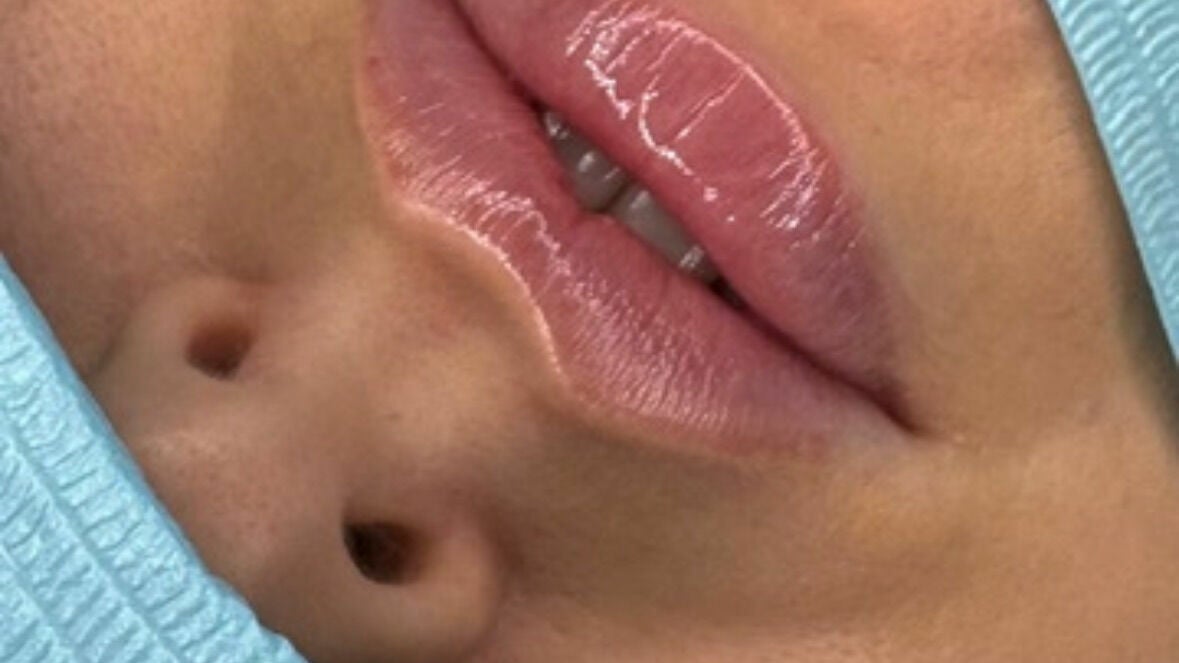 86269873-f1cc-4769-9c6b-91d1914ebd7e-chapter25aesthetics-bexley-gb-london-albanypark-fresha-2330522