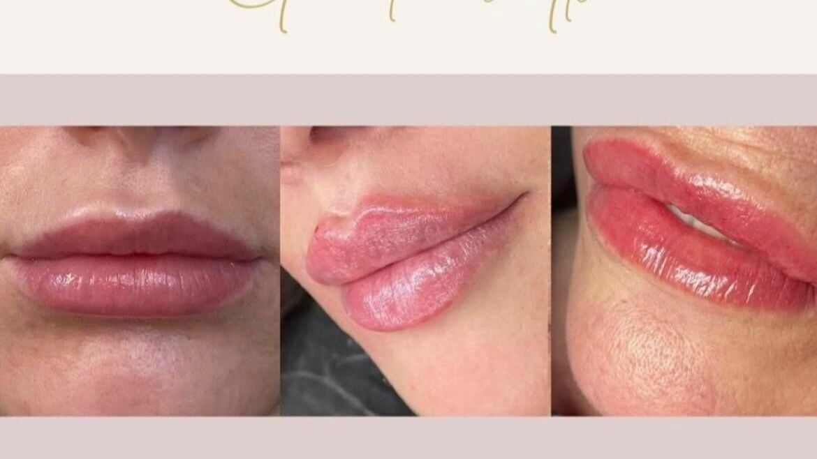 87196d5a-5245-419d-a87b-2161e396a65f-freshglowaesthetics-gb-england-cheslynhay-cheslynhay-fresha-8053545