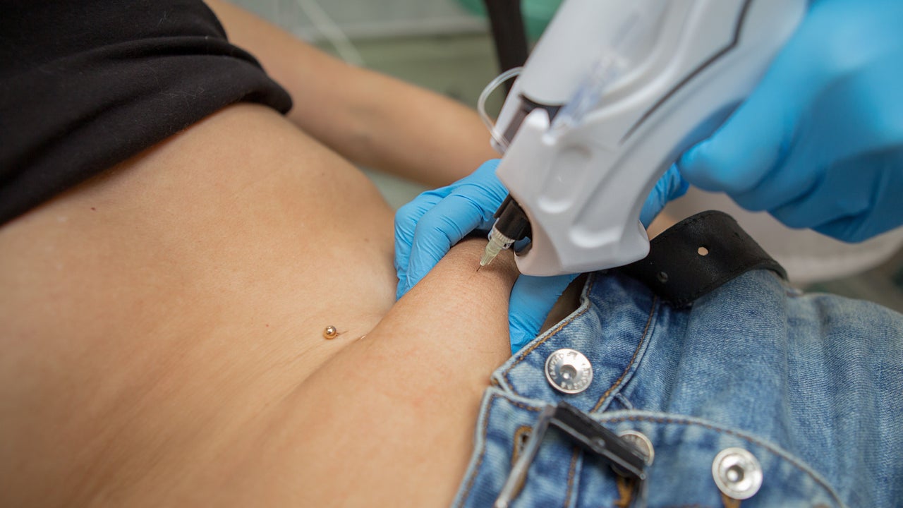 87e7f6ea-2c51-4c73-9fdf-bad08816013b-aestheticmedicalltd-gb-england-trowbridge-fresha-9800742