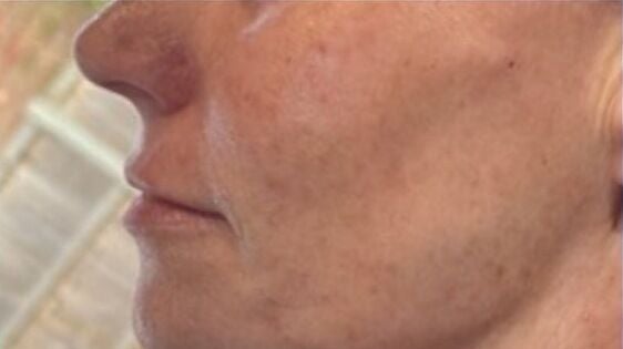 88ee6ca4-10cf-488e-8c62-f00513447fb0-jcaestheticsclinic-gb-england-ascot-fresha-3111348