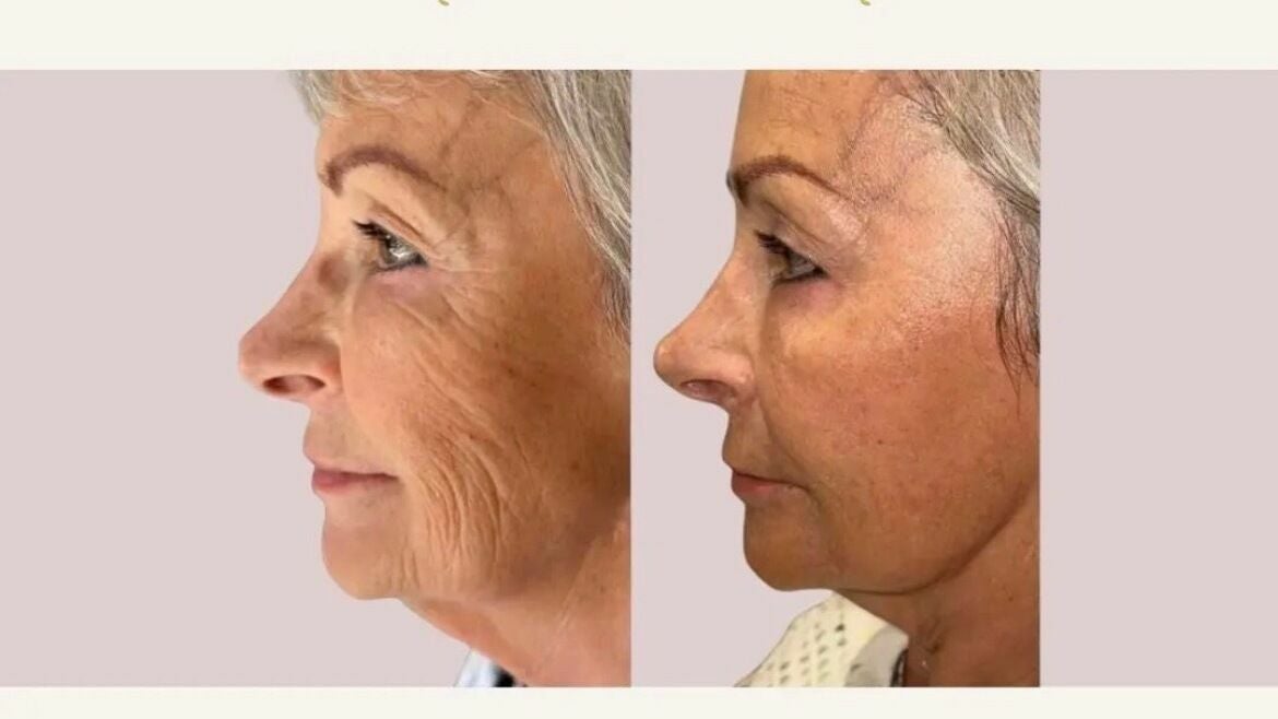 893f3810-5dc7-410a-85d9-b6bc4a4c7d13-freshglowaesthetics-gb-england-cheslynhay-cheslynhay-fresha-8706944