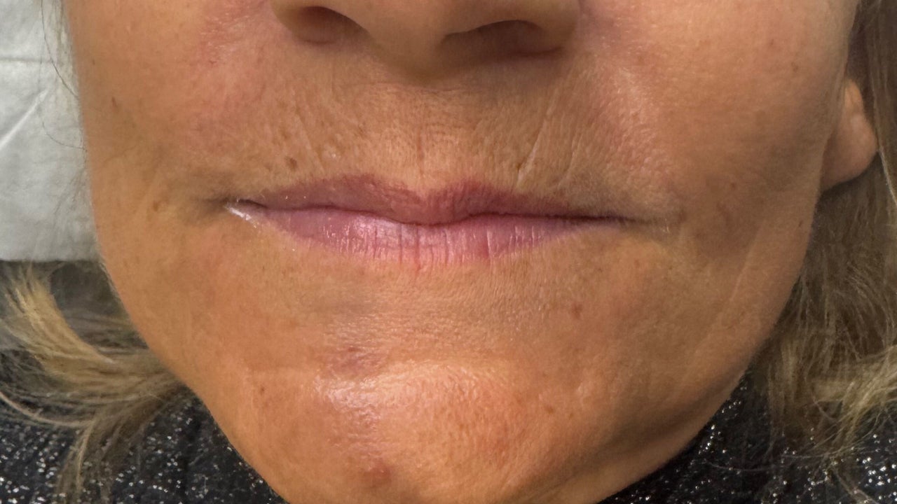 8a0d55e2-2dab-4225-b199-64ca7971ecbc-onthelashaesthetics-gb-england-wincanton-fresha-8338330