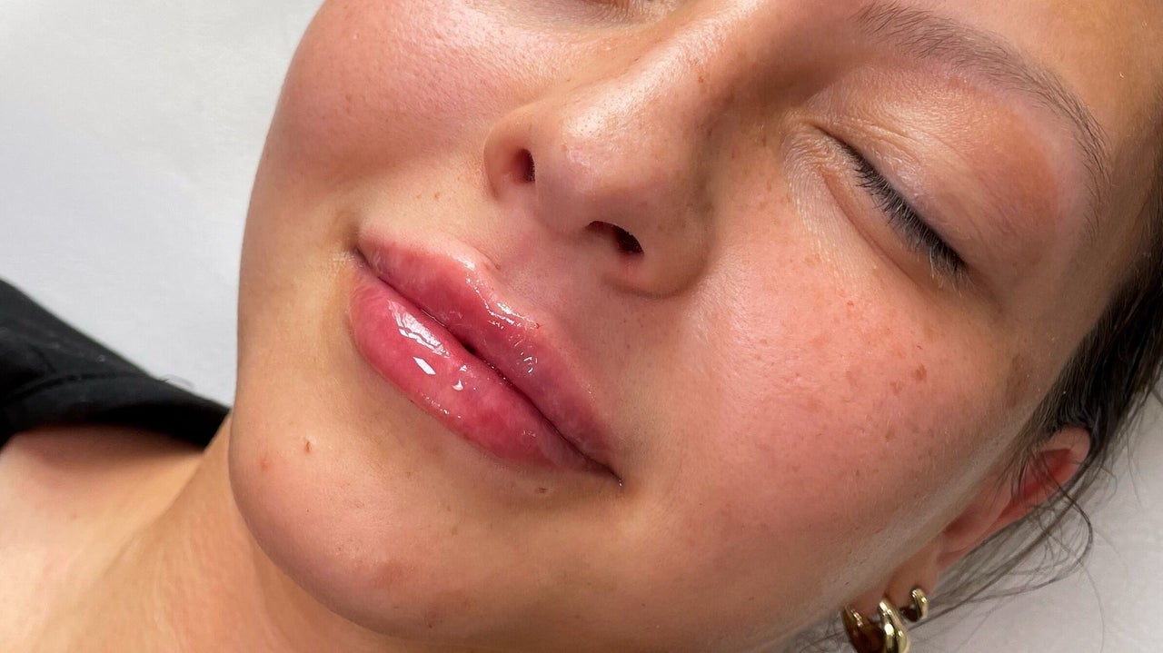 8aa7a409-ebed-452d-aebc-1cd942474988-barebeautyaesthetics-gb-england-newcastle-under-lyme-wolstanton-fresha-9772012