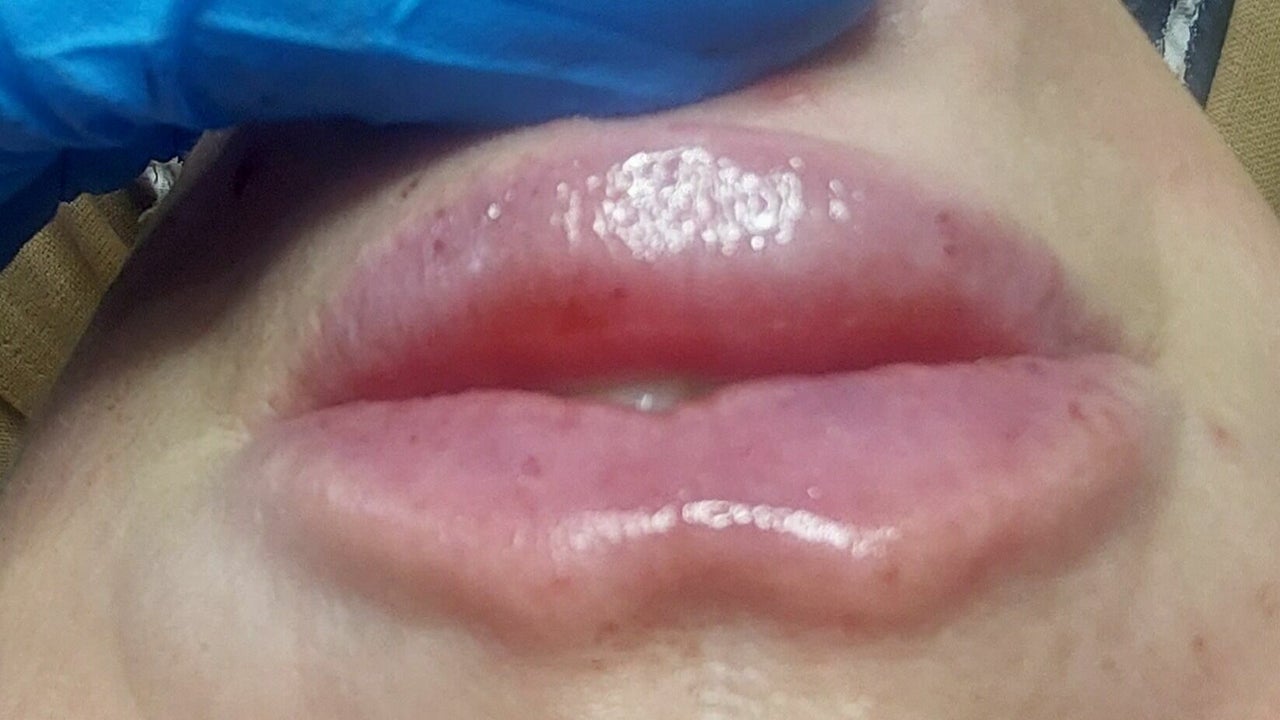 8bd22f1d-adeb-453a-9051-11277e4909de-3343226