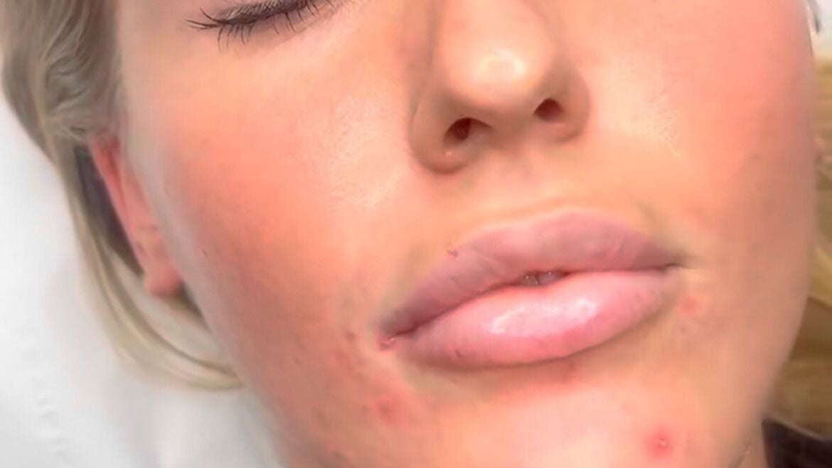 8e4b0943-2392-4131-b83c-816bcff3e5a0-charlotteleeaestheticsbeauty-gb-england-ash-fresha-4350756