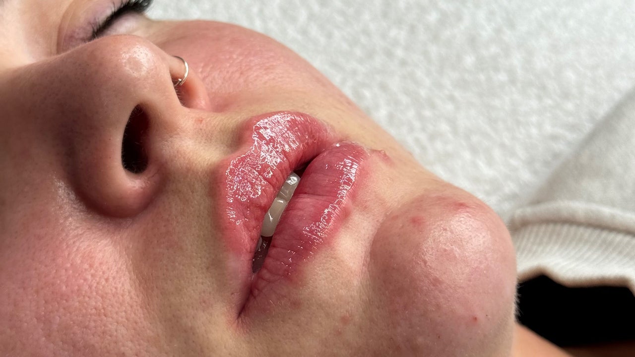 8e56515b-2590-4682-a1a1-5372879b4d7b-thedermacliniccheshire-gb-england-hyde-geecross-fresha-5571999