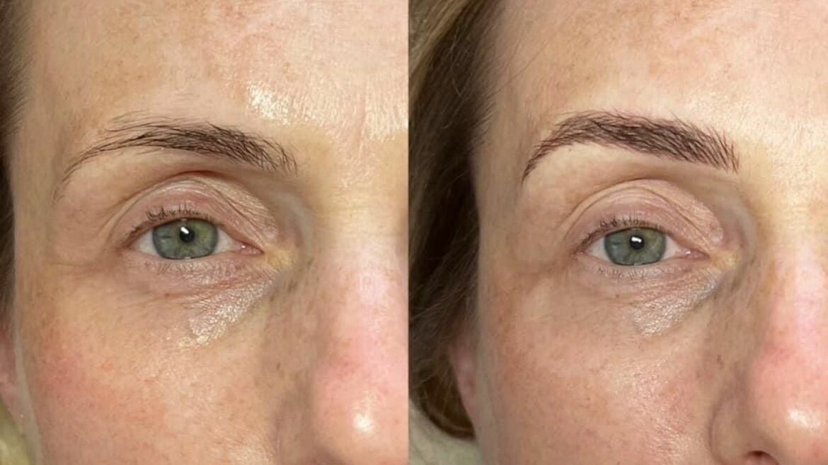 8ff72ff5-0dab-4b56-8ec5-3a489368a0f0-8606418