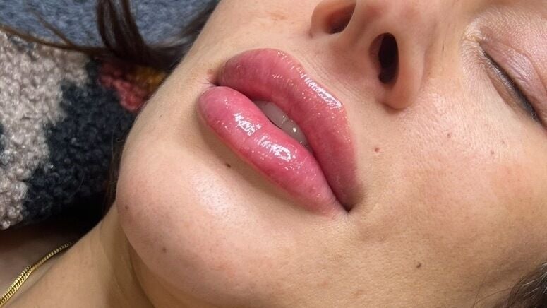 901cfbcd-2957-4c5b-9231-518789bf31d6-jcaestheticsclinic-gb-england-ascot-fresha-1887566