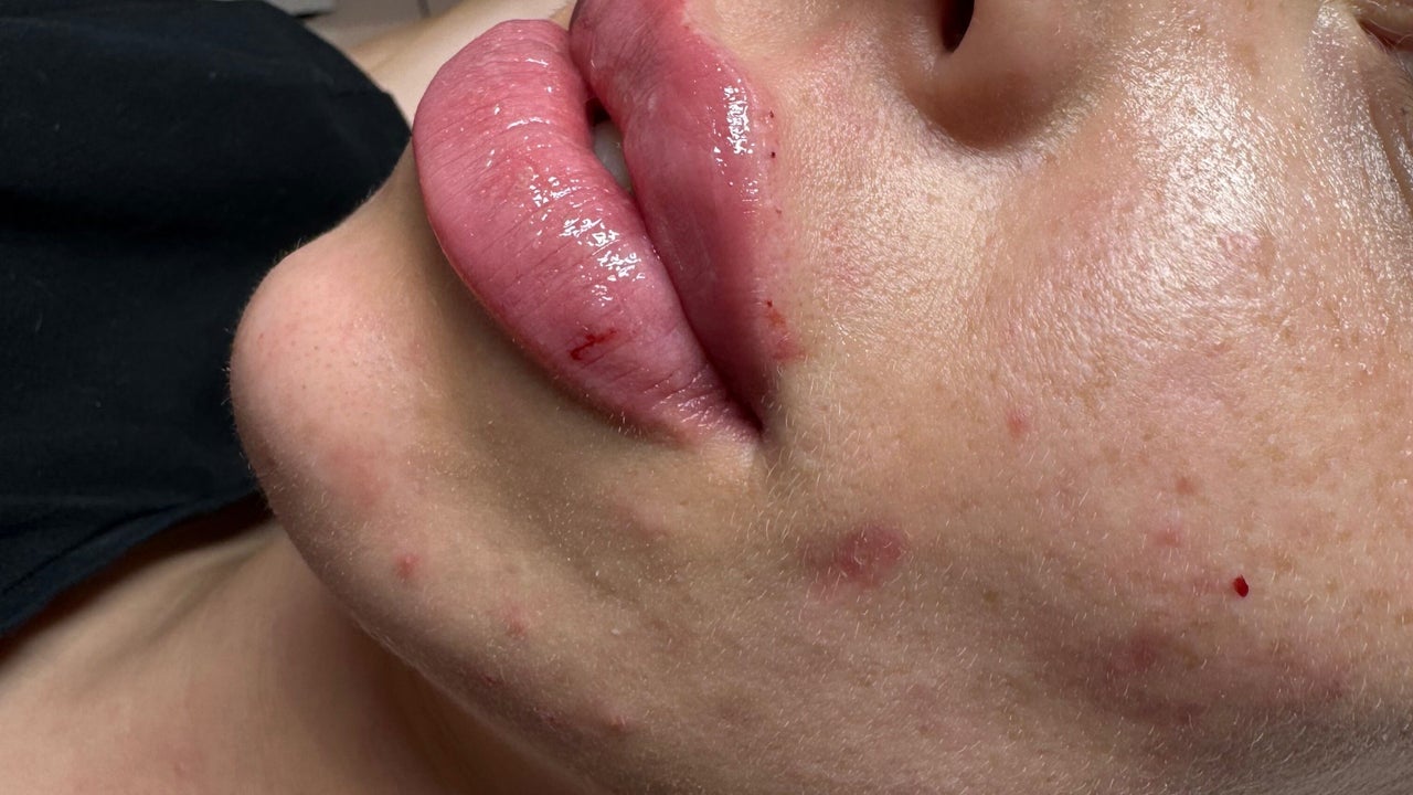 90c64d20-7fe2-49e1-96a5-99b0418553f8-dollyrocksbeautyaestheticslaser-gb-wales-gorseinon-fresha-5795611