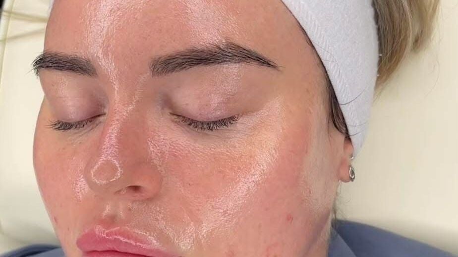 9158437d-e678-4405-8050-97758676b6f3-synergyaesthetics-gb-england-bexley-fresha-8316292