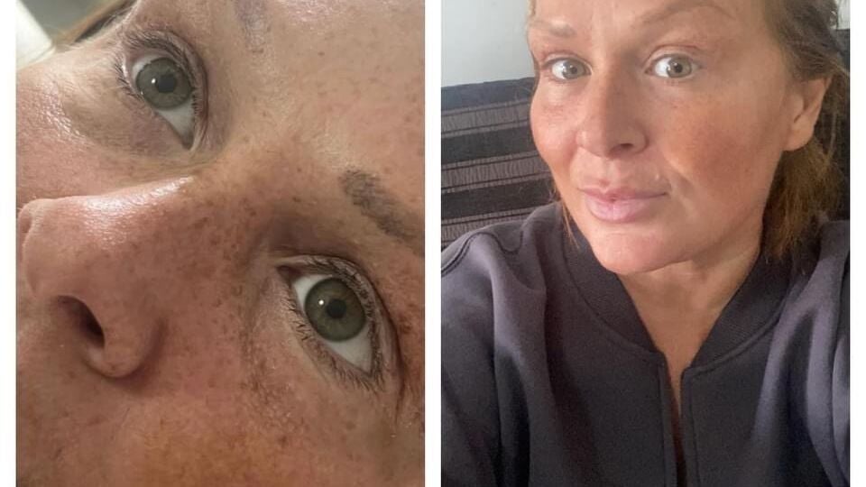 92e0a212-5056-426d-867c-f96fabb55a82-envymeaestheticsbeauty-gb-england-scunthorpe-fresha-4187819