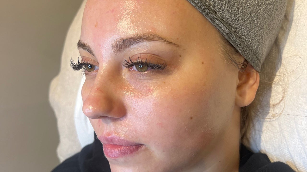 93314abe-cb51-48cc-ba78-e5de46c3dbf5-refreshskintherapy-gb-england-southampton-shirley-fresha-3867485