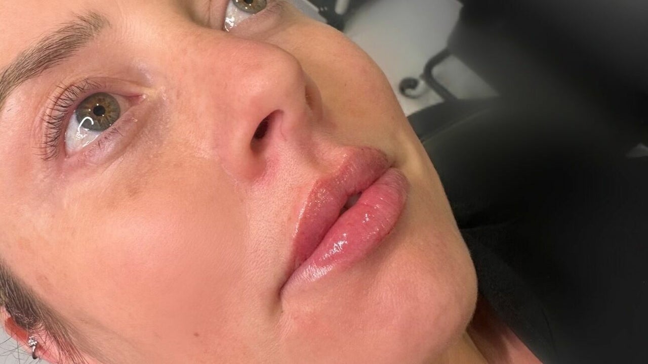 9406d2d4-b3c6-4301-9b39-c3e2336c8462-reenuaesthetics-gb-england-cannock-cannock-fresha-7241994