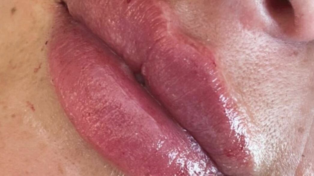 940bfd59-55bc-4fb2-bcec-ae21f2080316-debutaestheticsclinic-gb-england-wickford-fresha-9969168