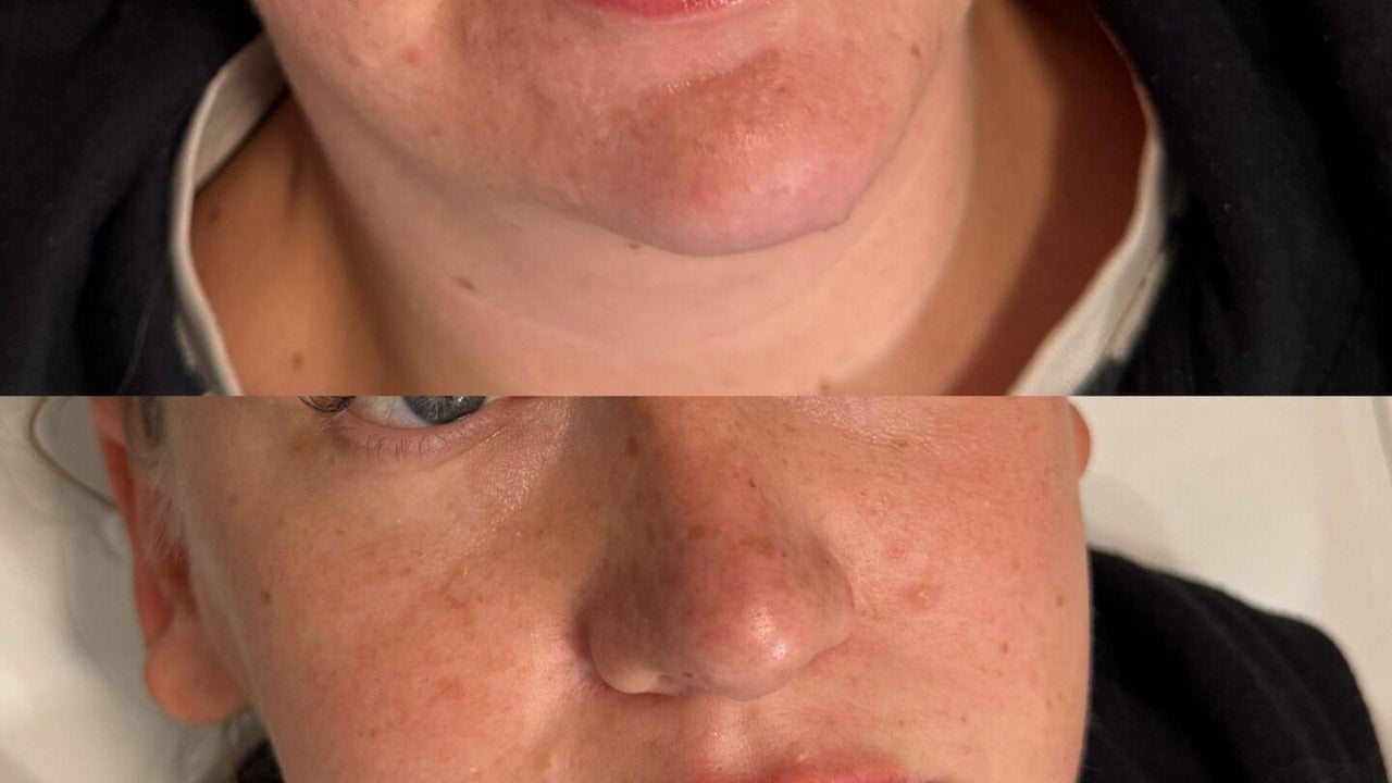 96f452ec-e988-4930-9319-6eb60585ce4e-jmemedicalaesthetics-gb-england-leyland-fresha-6771844