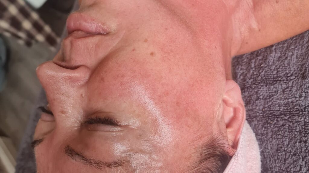 97a5af56-0776-47b4-96e7-8b4357a6fdb3-gsbeautyaesthetics-mobileonlylocaltong4-gb-england-netherfield-fresha-1657000