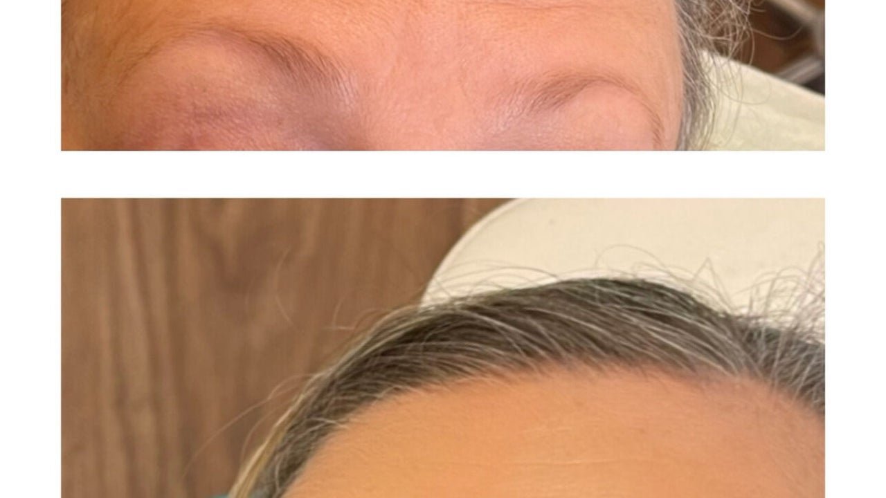 98cdd214-4793-4810-8f2b-703d19a891d0-emaestheticsbishopsstortford-gb-england-greathallingbury-fresha-2976803