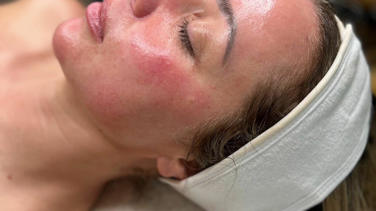 99ef5f38-0a43-4015-acdb-f73c50859923-emskinclinic-sandbach-gb-england-sandbach-fresha-4778246