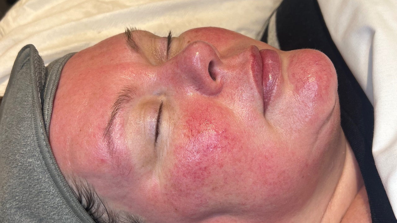 9bd32c16-35a6-409c-9ad7-25d25f3450a5-refreshskintherapy-gb-england-southampton-shirley-fresha-1672872