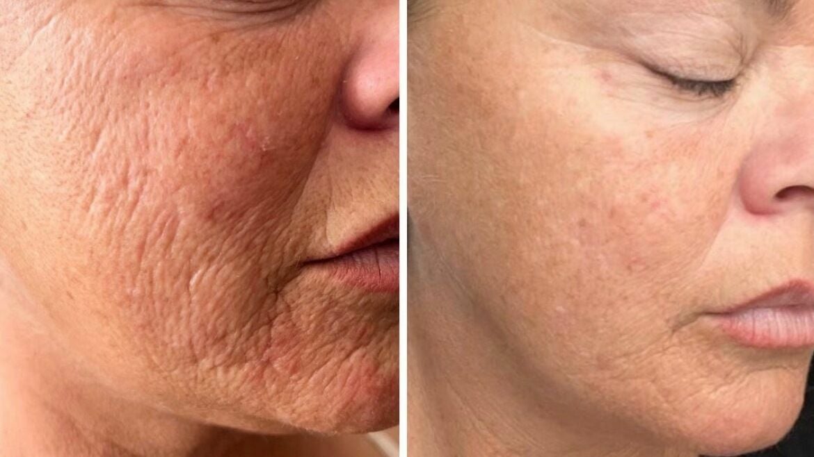 9bfc8120-1695-44ec-a069-ea0e46ee0467-4546222