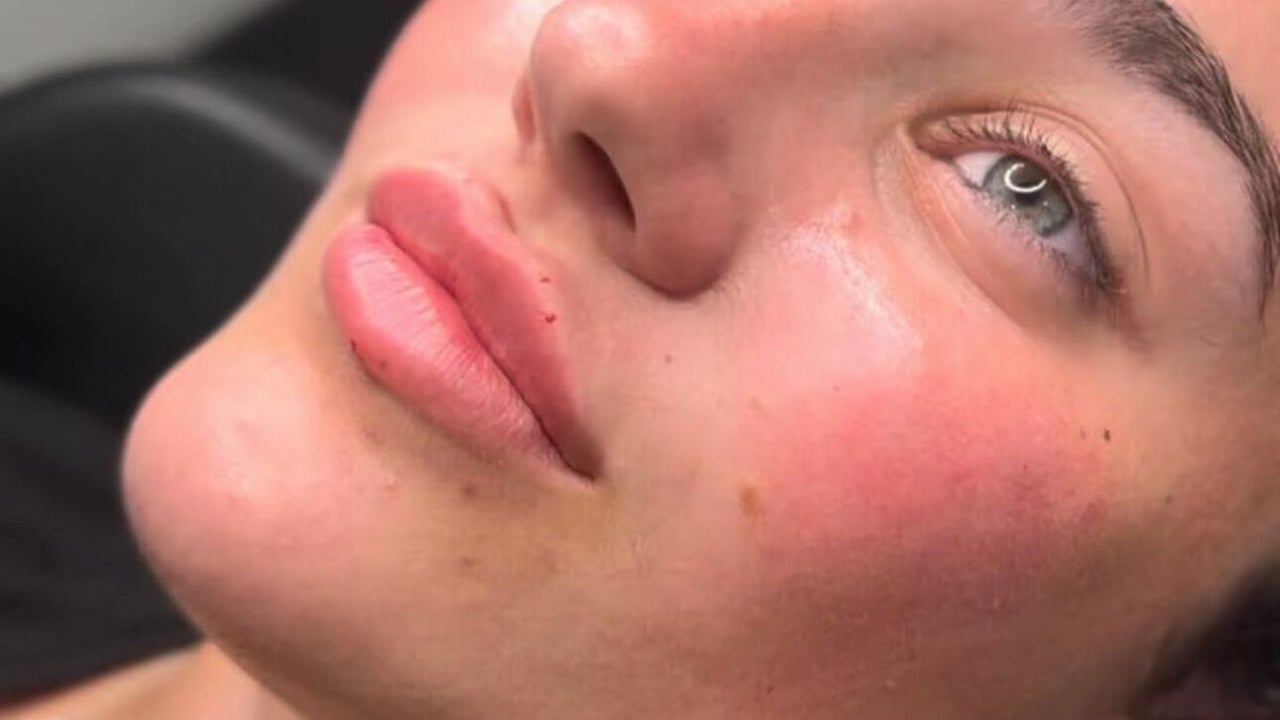 9d47512c-1027-460d-8c94-d105c0688252-reenuaesthetics-gb-england-lichfield-fresha-7291519