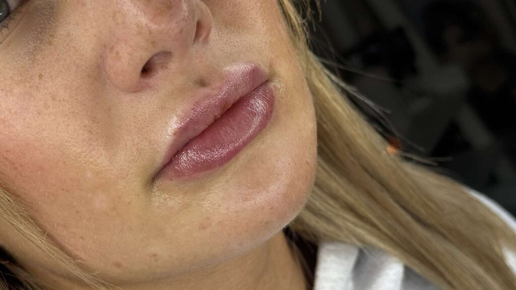 9fba1fbe-b02d-42fe-8d53-71ab273ec6f9-envymeaestheticsbeauty-gb-england-scunthorpe-fresha-1661762