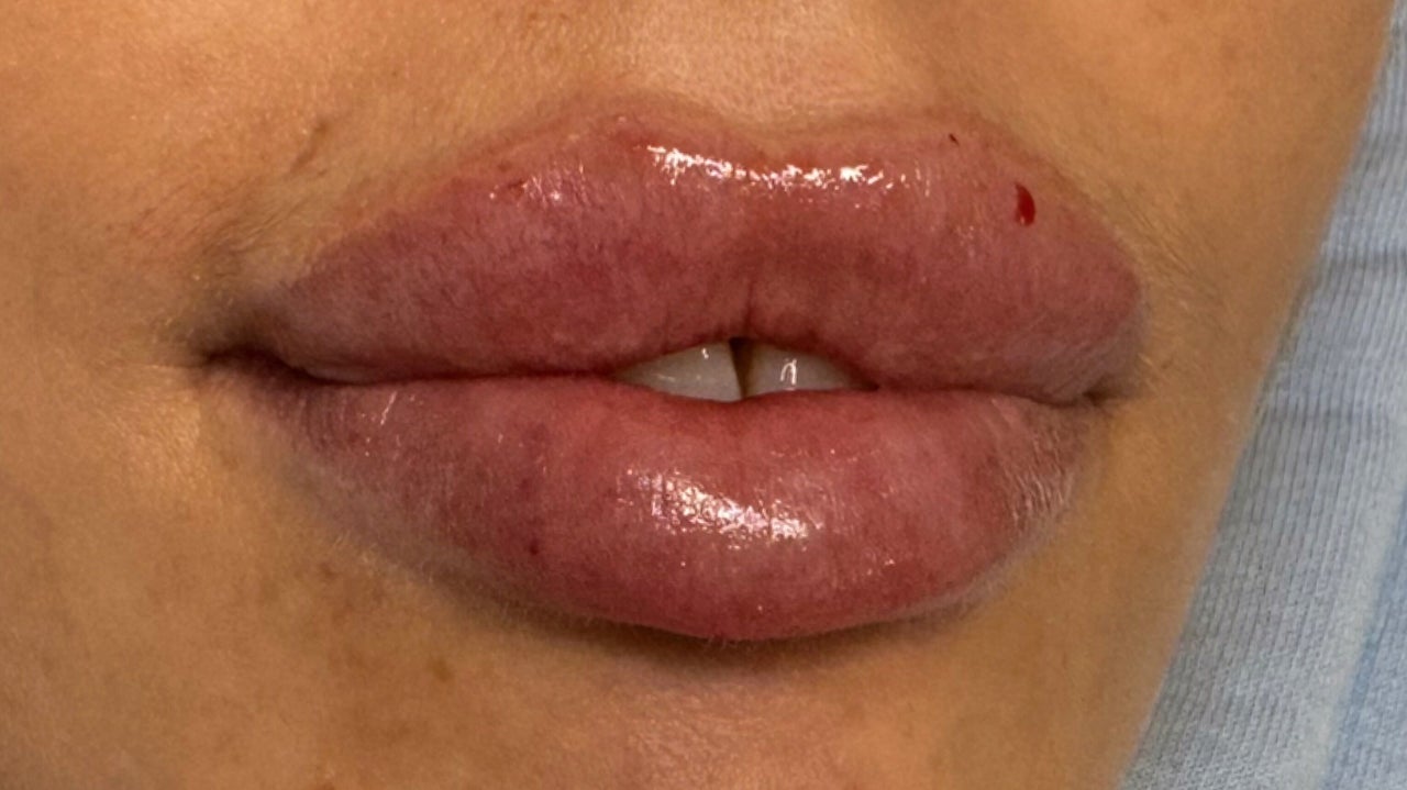 9ff578d4-9d8b-46a4-8654-95ffb73a6730-onthelashaesthetics-gb-england-wincanton-fresha-7671398