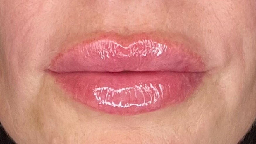 a0a466b7-bd9d-46c9-8b8d-884c85bd0b39-jcaestheticsclinic-gb-england-ascot-fresha-5694972