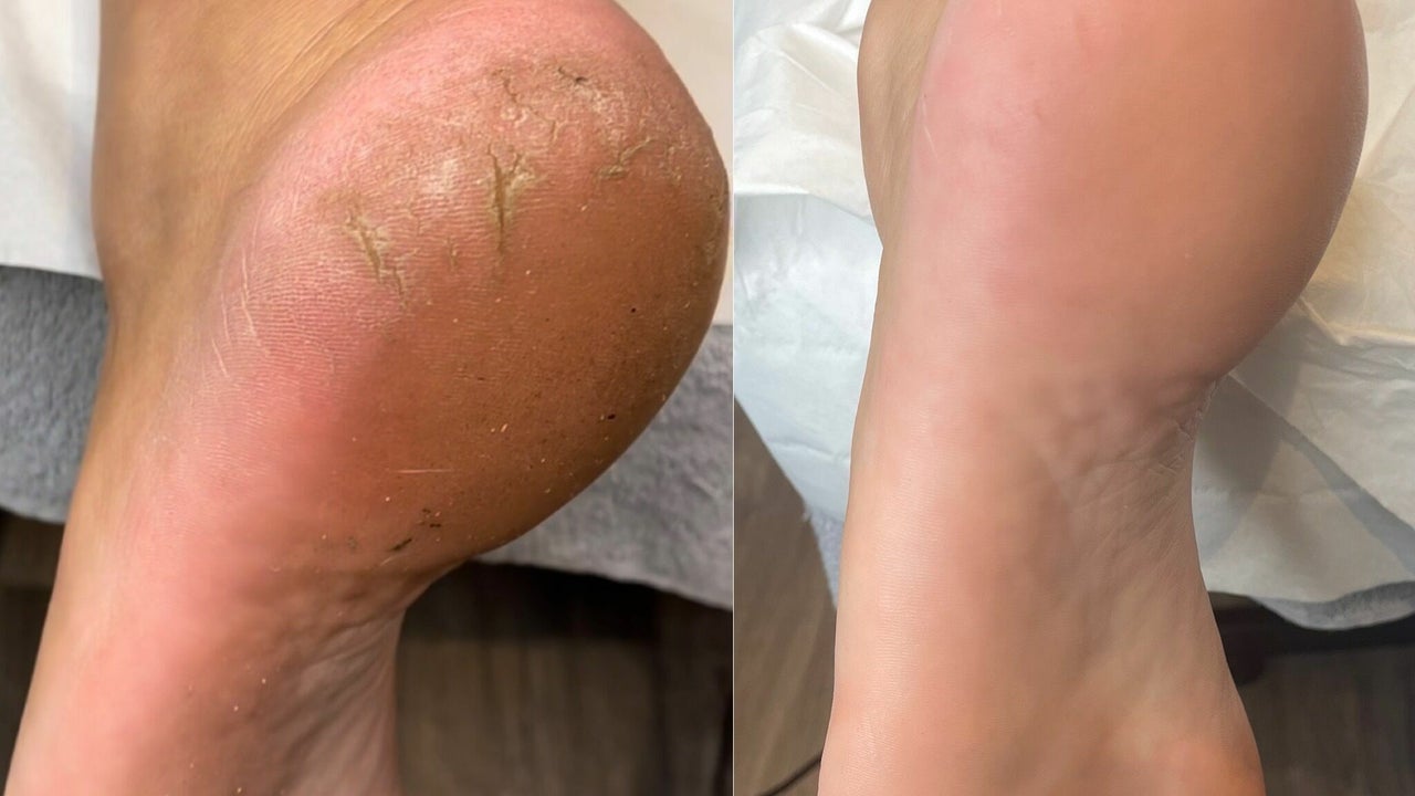 a0e60a11-768d-40fc-b383-1f940e29652e-4271740