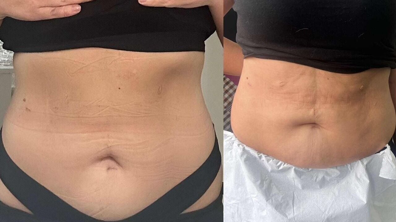 a16023e4-813f-45c5-9877-ffe54a37a6e2-pulsarlaserchorley-gb-england-chorley-fresha-8364115