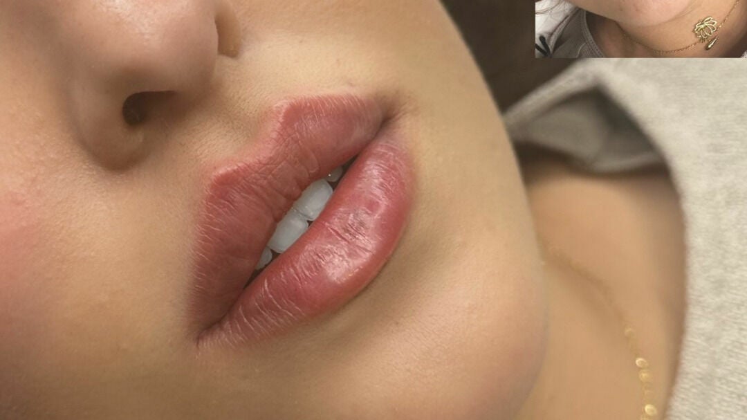 a1960207-80fc-4f2b-9039-5d1cd487d770-blushbeautygreenfordclinic-gb-england-greenford-fresha-1049804