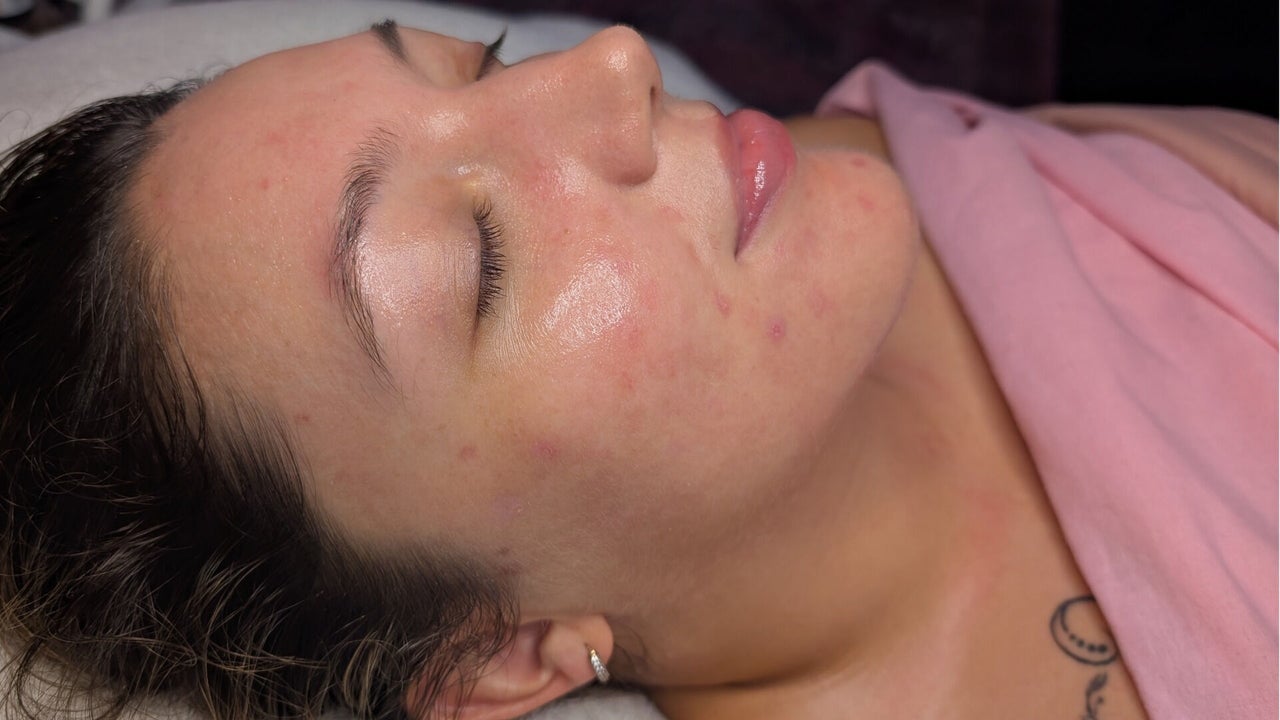 a41b2a39-1365-4fe7-a6bb-6f149970525f-skinfitstudio-gb-england-shifnal-fresha-5194119