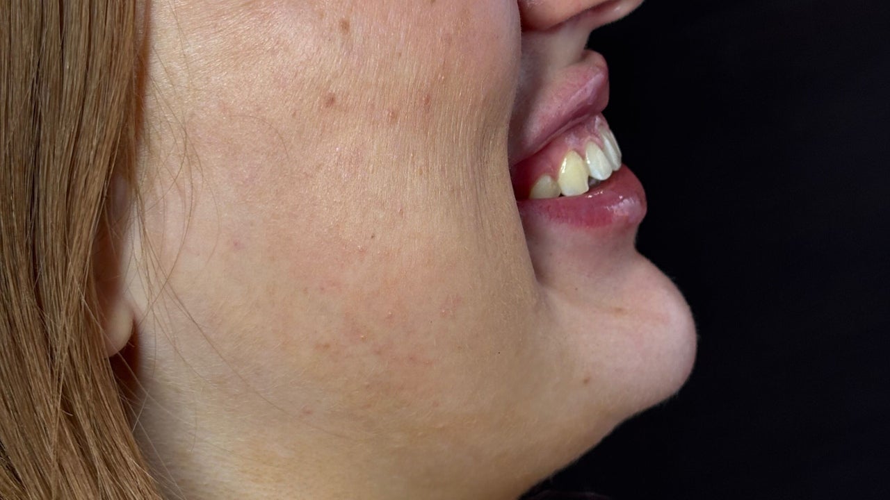 a47348bc-88be-4d90-bf71-8273a0279775-angelicaestheticsandcosmetics-gb-england-canterbury-fresha-4466814