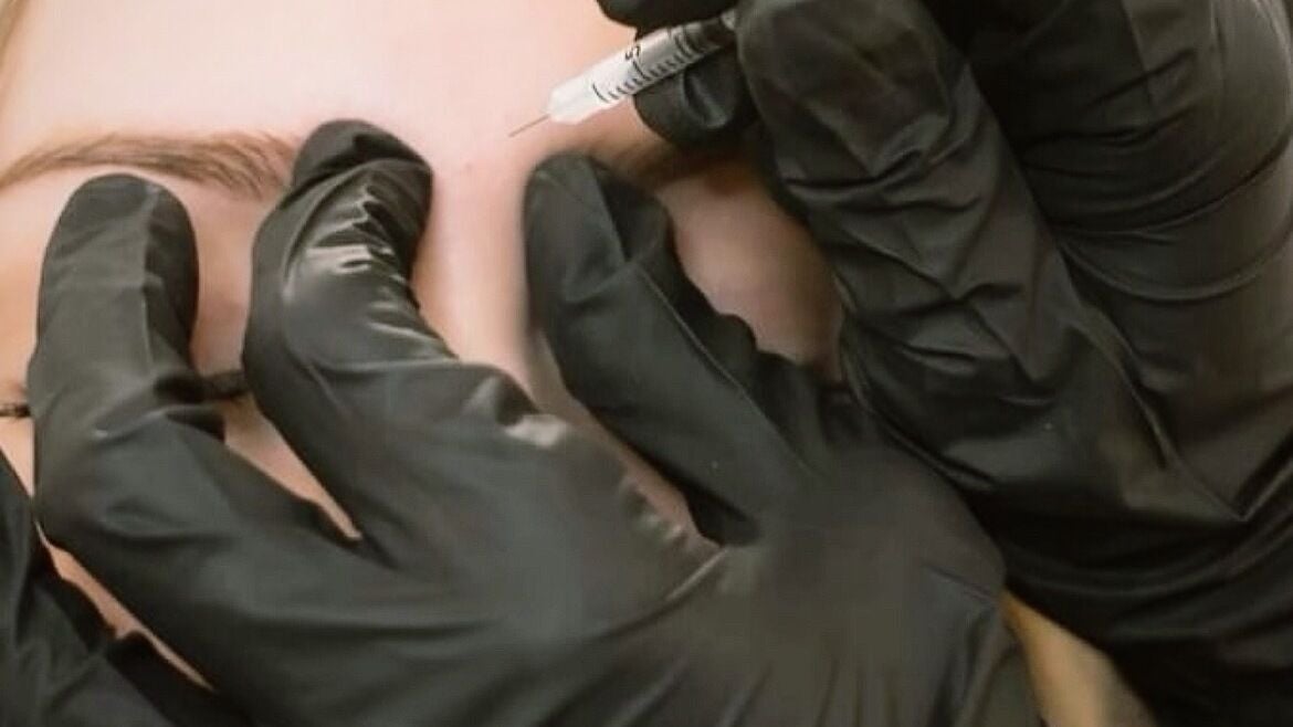 a4c6f379-f0a6-4b53-b22a-2d1c2afcc1f7-ahnurseaestheticsatthestablesbeautyskinclinic-gb-england-ackworth-fresha-6925249