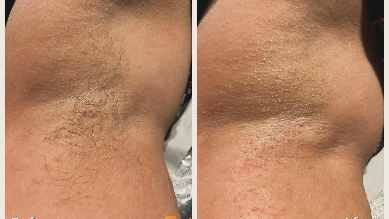 a7113c66-3e39-405e-af6a-7dc1ae962716-8252452